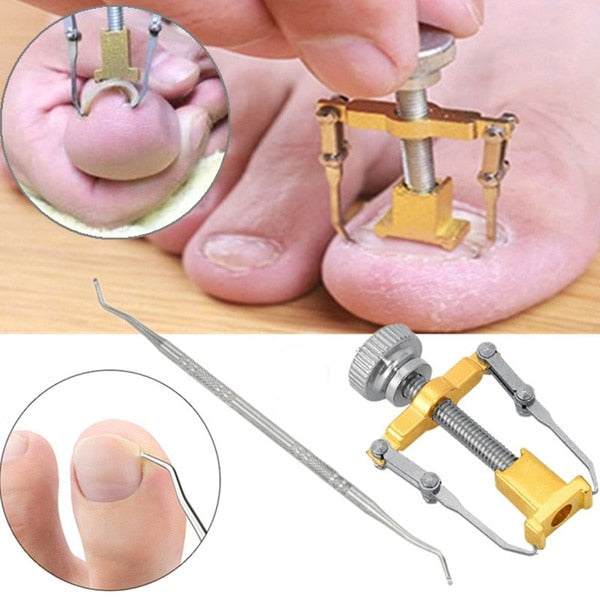 Ingrown Toe Nail Fixer Pedicure Recover Embed Toenail Correction Lifter Tool Set