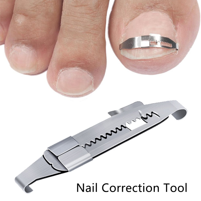 Ingrown Toe Nail Correction Tool Toenail Straightening Correctors Patch Tool Straightening Clip Brace Pedicure Tool